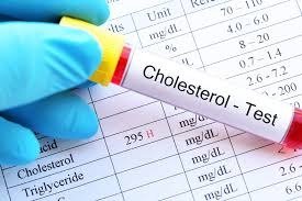 TOTAL CHOLESTEROL